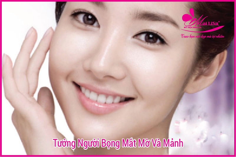 Người có bọng mắt to đẹp hay xấu? tướng số có tốt không? Tướng người không có bọng mắt