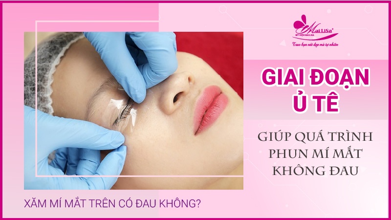 Phun mí mắt có đau không? Những lưu ý cần biết khi phun mí mắt phun mí mắt mèo