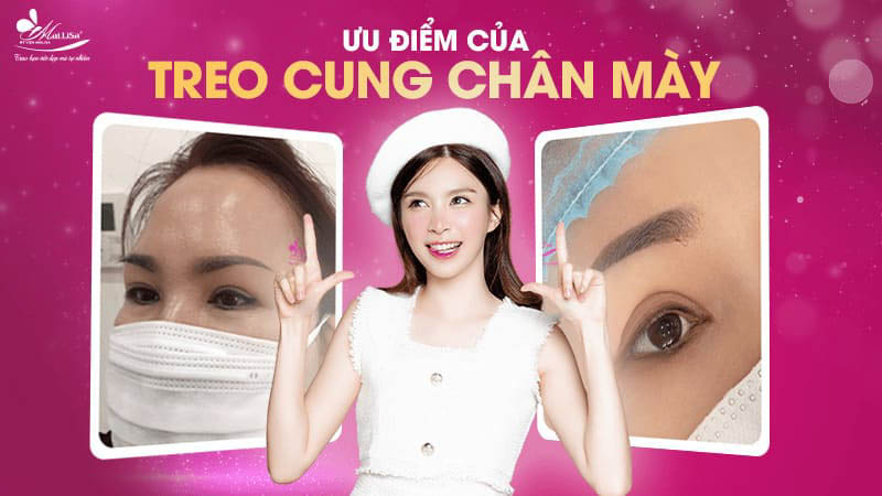 Treo chân mày là gì và có những phương pháp nào năm 2024 9 - 9 treo chân mày uu diem nang cung chan may giau chi