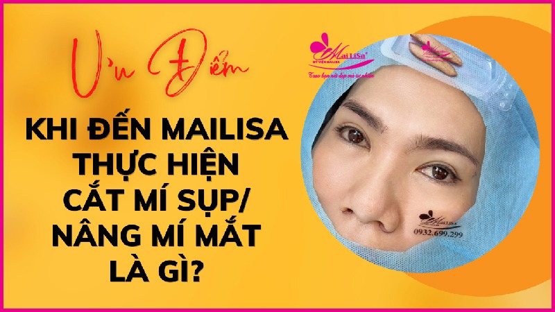 Phẫu thuật nâng cơ mí mắt là gì? Giá bao nhiêu HỢP LÝ 2023? Ưu điểm cắt mí tại mailisa