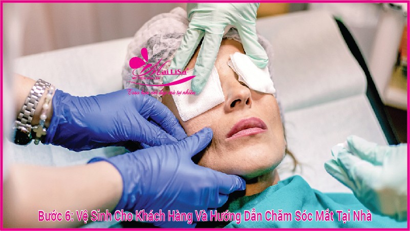 Phẫu thuật nâng cơ mí mắt là gì? Giá bao nhiêu HỢP LÝ 2023? Vệ sinh hướng dẫn khách chăm sóc tại nhà