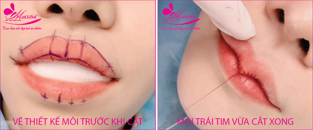 Tạo môi trái tim Hàn Quốc Tạo môi trái tim Hàn Quốc