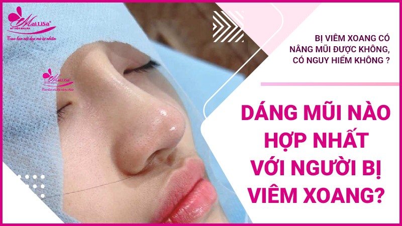 Bị viêm xoang có nâng mũi được không, có nguy hiểm không ? dáng mũi phù hợp với người bệnh viêm xoang