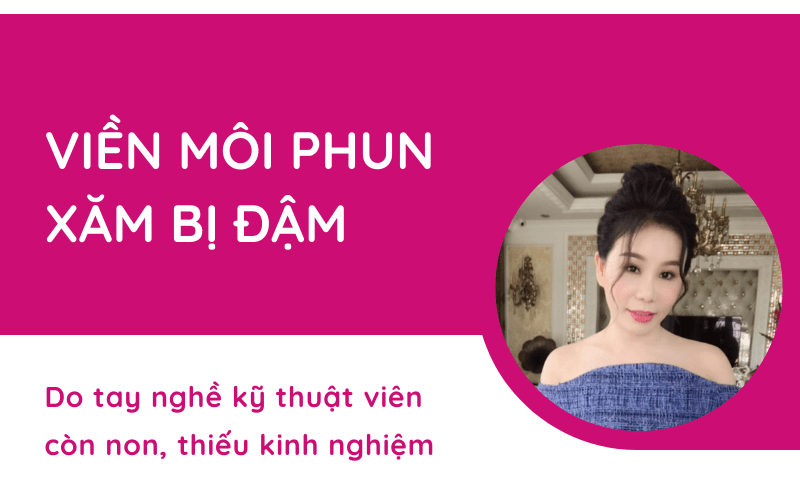 5 cách xử lý làm mờ vết viền xăm môi đậm tại nhà HIỆU QUẢ trong TIK TOK viền môi xăm bị đậm