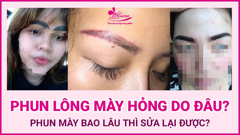 Xăm chân mày lỗi bao lâu sửa được? Cách chỉnh sửa lông mày bị lỗi 2022 chân mày hư do đâu
