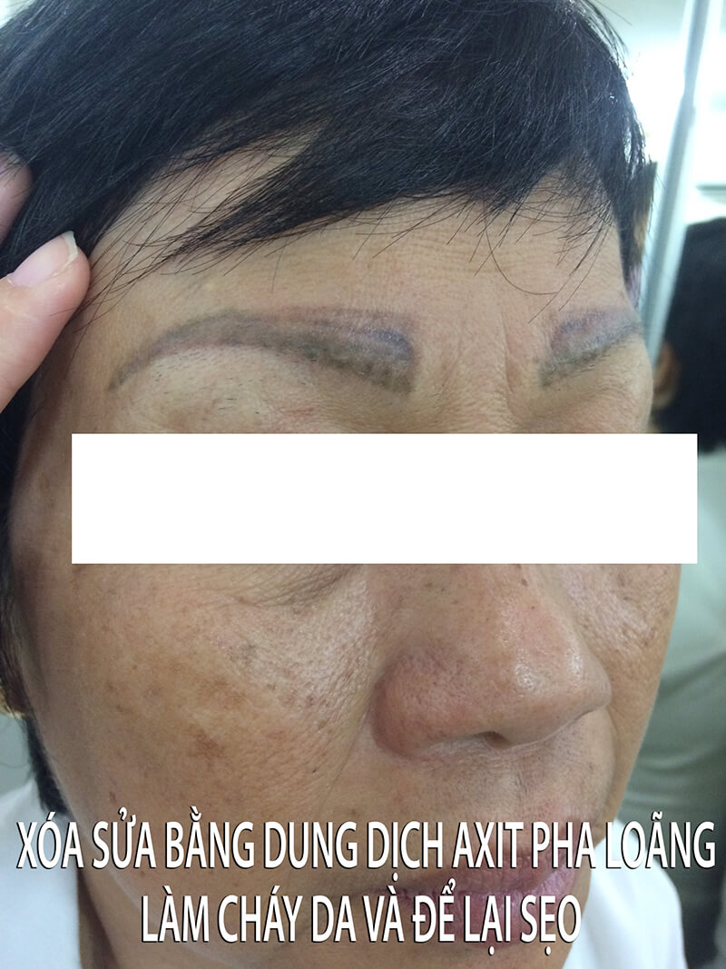 Nên chọn điêu khắc chân mày hay phun chân mày – Chuyên gia tư vấn Nên chọn điêu khắc chân mày hay phun chân mày – Chuyên gia tư vấn