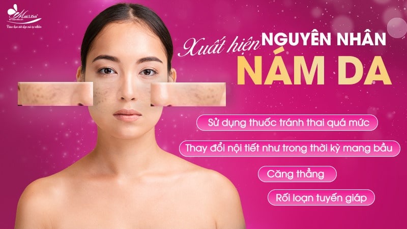8 Cách trị đốm nâu trên mặt thịnh hành hiện nay 4 - 4 đốm nâu trên mặt xuat hien dom nau tren da chan