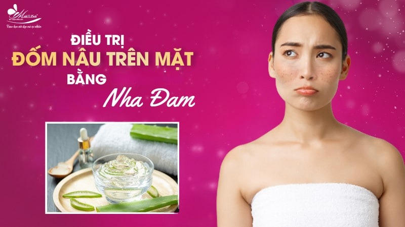8 Cách trị đốm nâu trên mặt thịnh hành hiện nay 9 - 9 đốm nâu trên mặt xuat hien dom nau tren da tay