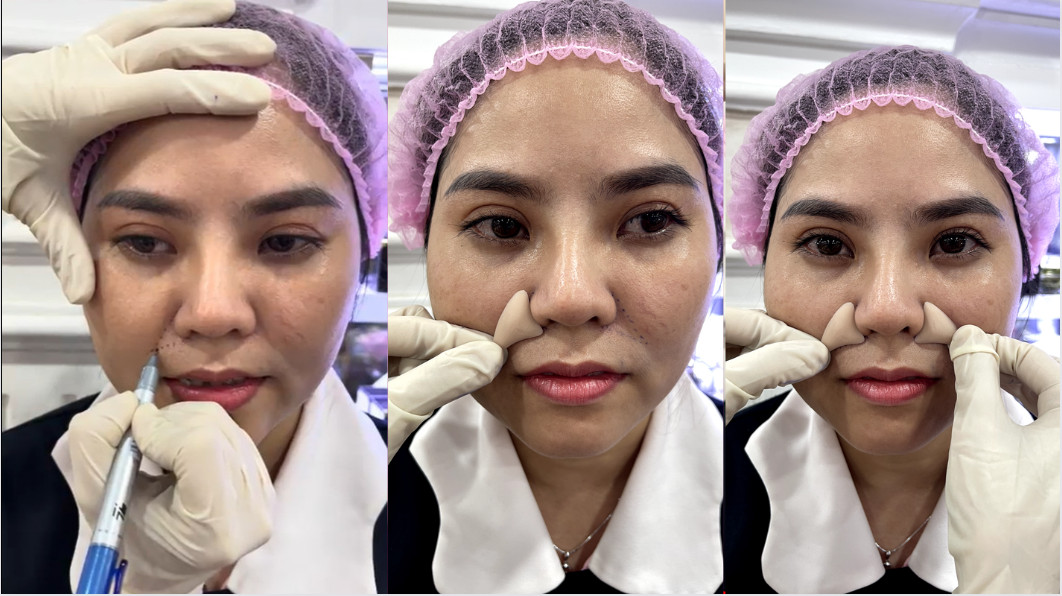 Làm đầy rãnh cười Babies line Làm đầy rãnh cười Babies line