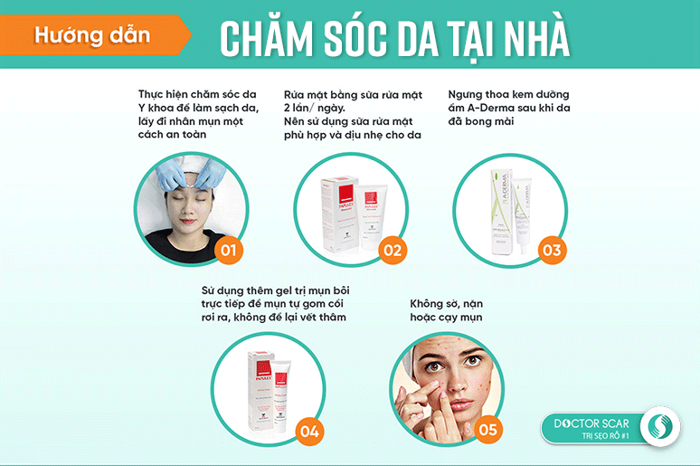 3-cach-tri-mun-sau-dieu-tri-seo-ro