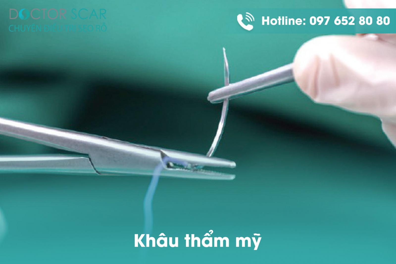 cat-seo-loi-va-khau-tham-my Cắt sẹo lồi và khâu thẩm mỹ