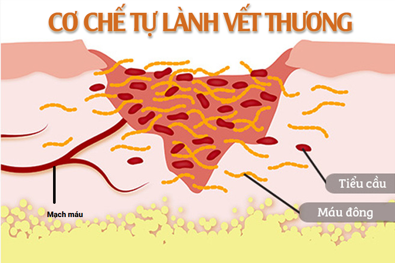 co-che-tu-lanh-thuong-cua-co-the-trong-dieu-tri-seo-ro co-che-tu-lanh-thuong-cua-co-the-trong-dieu-tri-seo-ro
