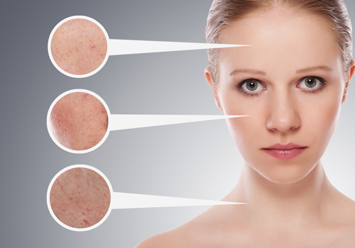 da511 trị sẹo rỗ, sẹo thâm bằng laser có an toàn không
