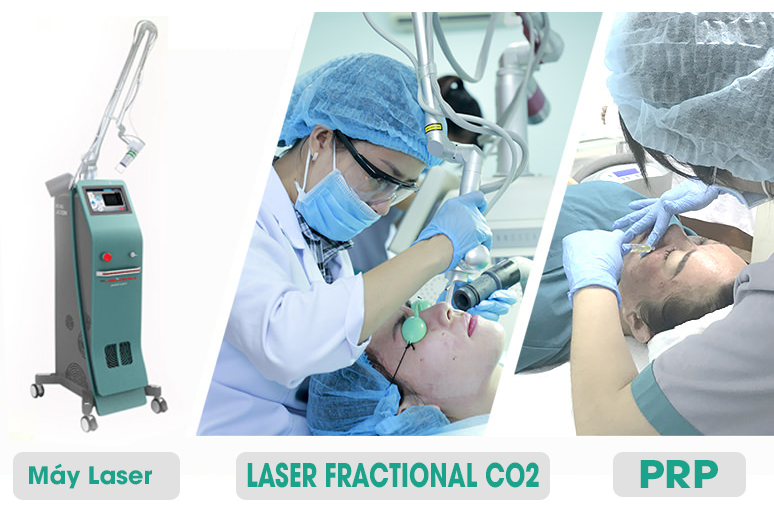 image25 điều trị sẹo lồi tại doctor scar