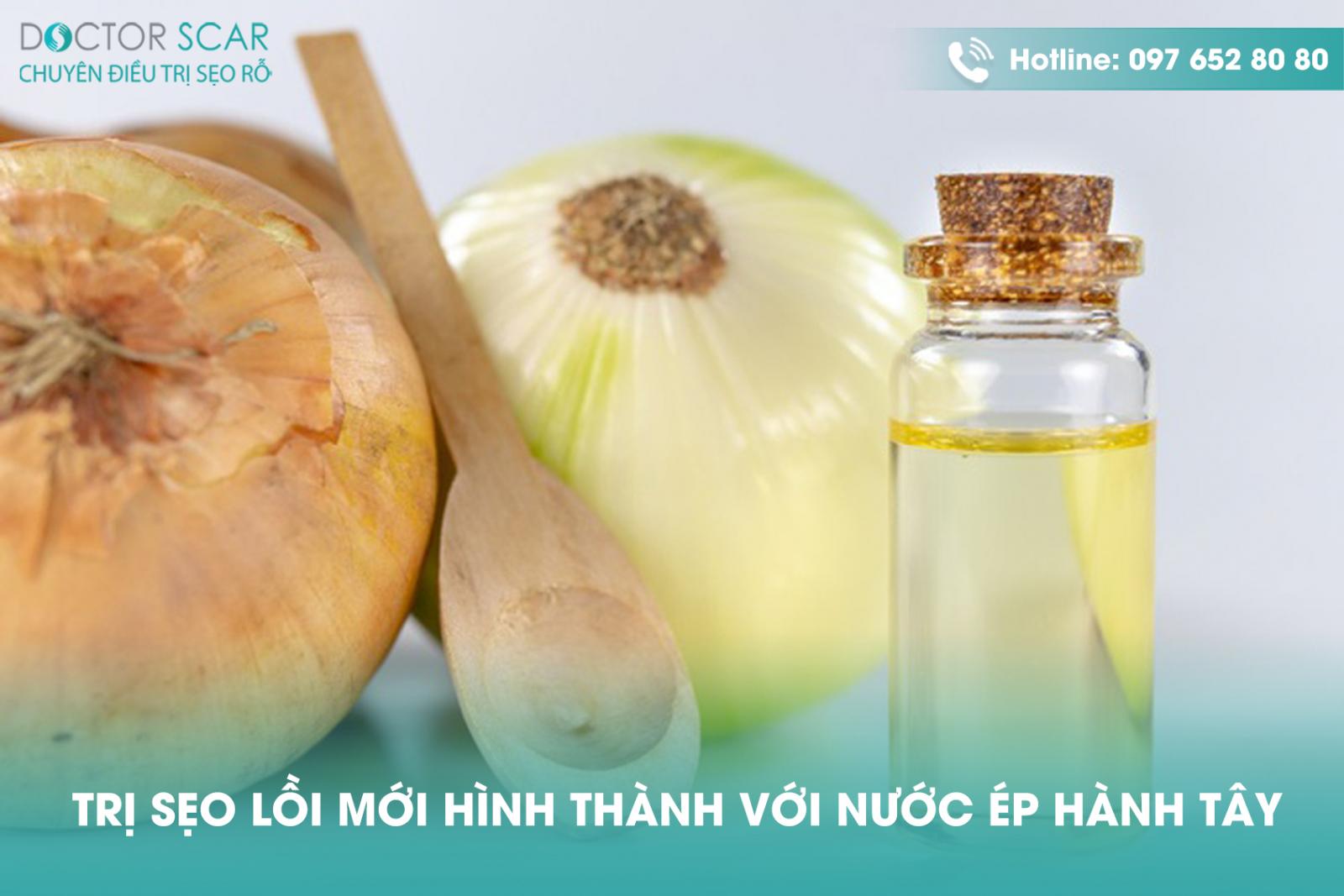 tri-seo-loi-moi-hinh-thanh-voi-nuoc-ep-hanh-tay Trị sẹo lồi mới hình thành với nước ép hành tây