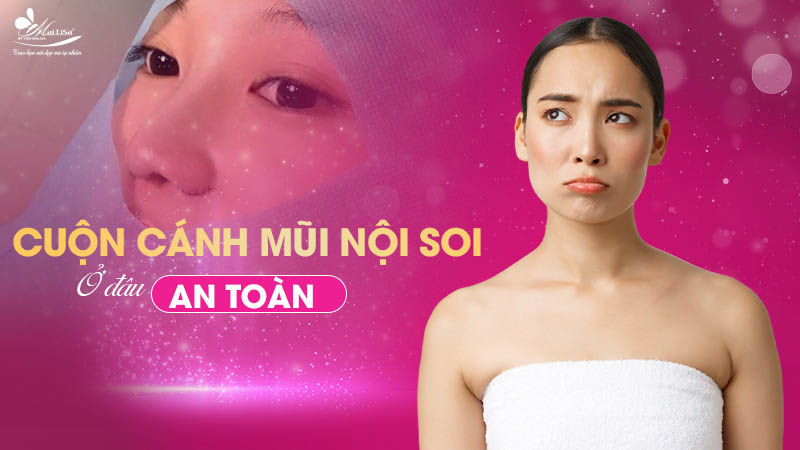 Cuốn cánh mũi bao nhiêu tiền? Bảng giá mới nhất 2024 8 - 8 cuốn cánh mũi bao nhiêu tiền cuon canh mui noi soi o dau an toan