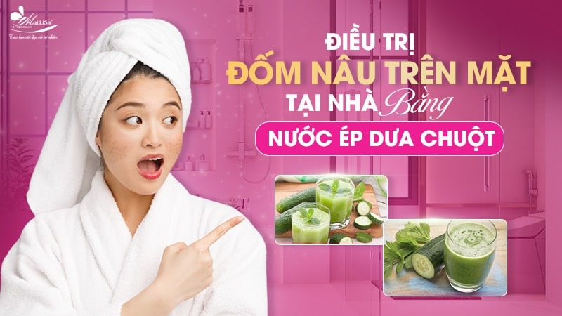 8 Cách trị đốm nâu trên mặt thịnh hành hiện nay 11 - 11 đốm nâu trên mặt da noi dom nau khong ngua