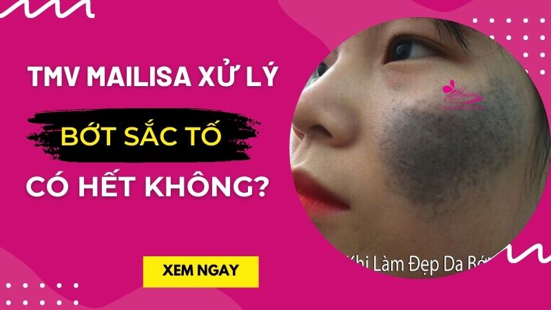 Thẩm mỹ viện Mailisa có lừa đảo khách hàng? THỰC HƯ CÁC TIN ĐỒN trong ngành THẨM MỸ thực hư tin đồn mailisa lừa đảo phải không