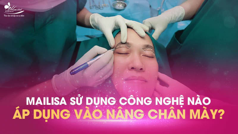 Treo chân mày là gì và có những phương pháp nào năm 2024 17 - 17 treo chân mày nang cung chan may bang cong nghe cao tai mailisa